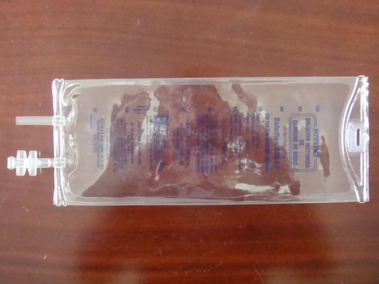 EO Sterilizasyon 5000ml Tek Kullanımlık İnfüzyon Torbası